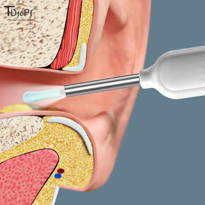 Earify Replacement Tips